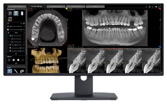 tomografia dental, tomografia odontologica